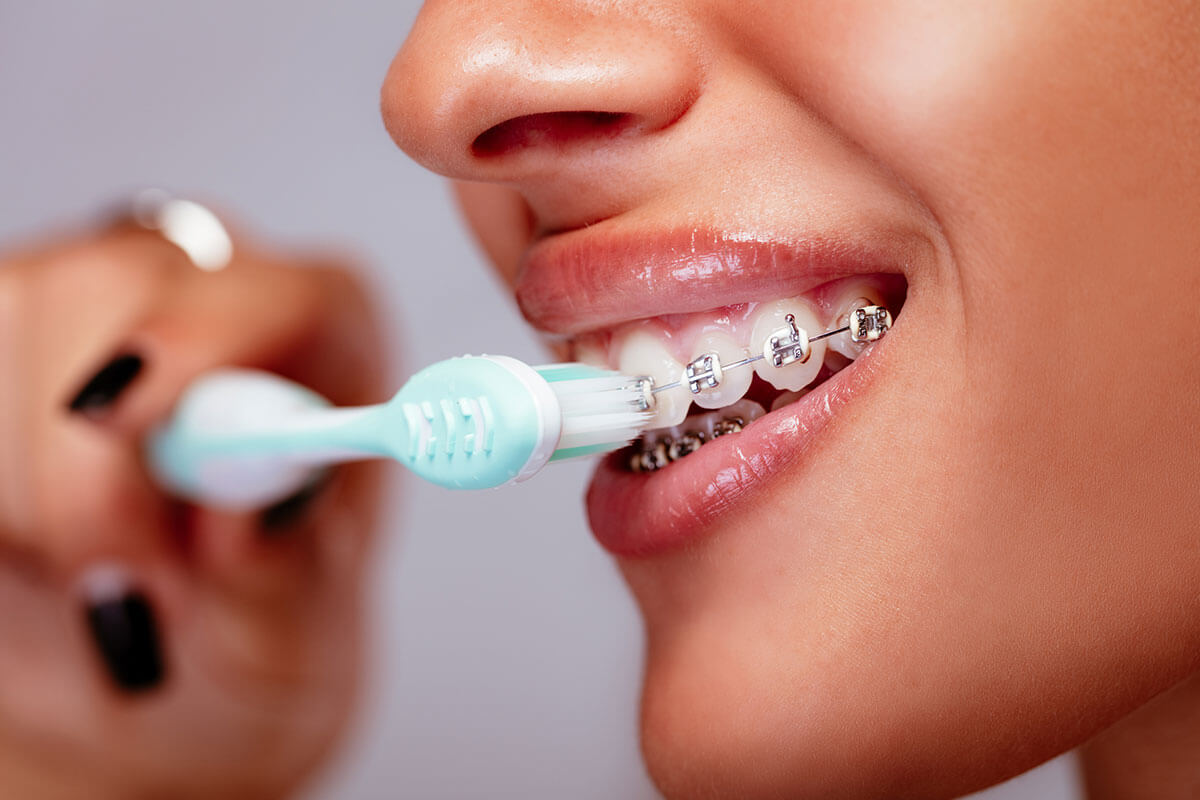 How To Brush Teeth With Braces Greater Hartford Orthodontics