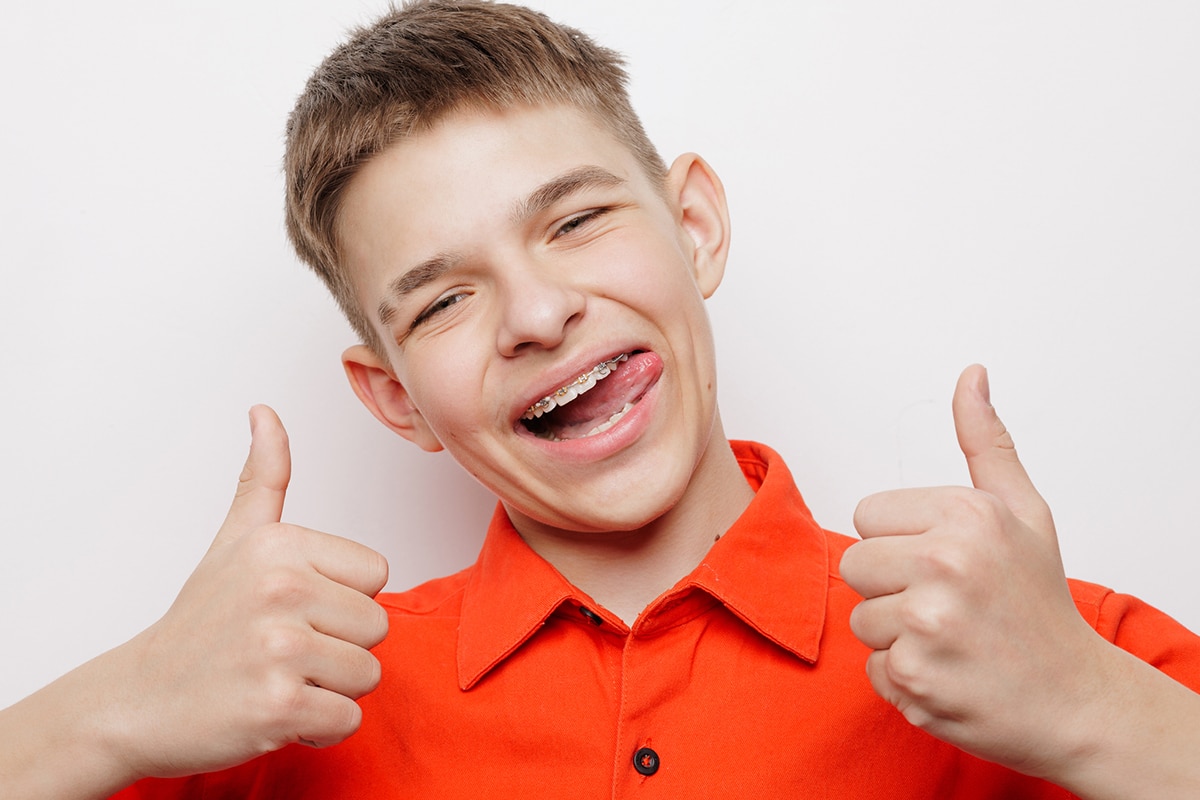 Can you play sports with metal braces blog