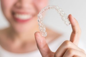 a person shows off a clear aligner